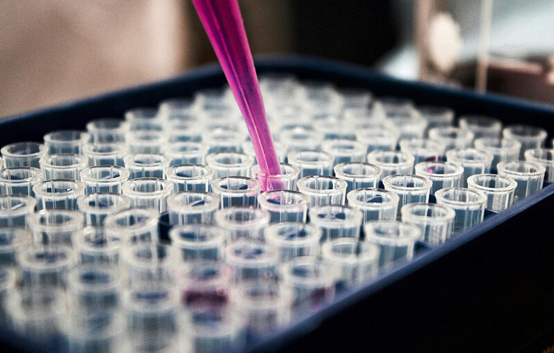 AI-Driven ERP Systems Transforming Singapore’s Pharmaceutical Industry